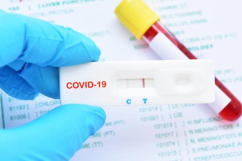 L'immunité est en effet un des facteurs majeurs qui conditionnent la circulation du virus (Visuel Adobe Stock 325405756) L'immunité est en effet un des facteurs majeurs qui conditionnent la circulation du virus (Visuel Adobe Stock 325405756)