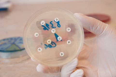 Une molécule appelée « pSma1 » présente dans des échantillons de cellules bactériennes patients atteints de colite ulcéreuse sévère est retrouvée dans certaines souches de Campylobacter concisus (C. concisus), une bactérie qui vit habituellement dans la bouche (Visuel Adobe Stock 95277279) Une molécule appelée « pSma1 » présente dans des échantillons de cellules bactériennes patients atteints de colite ulcéreuse sévère est retrouvée dans certaines souches de Campylobacter concisus (C. concisus), une bactérie qui vit habituellement dans la bouche (Visuel Adobe Stock 95277279)