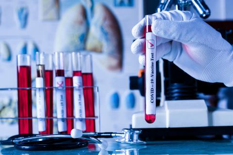 Les personnes qui se rétablissent plus rapidement du COVID-19 sont aussi celles qui développent une réponse immunitaire plus efficace et plus durable au virus (Visuel Adobe Stock 332945564). Les personnes qui se rétablissent plus rapidement du COVID-19 sont aussi celles qui développent une réponse immunitaire plus efficace et plus durable au virus (Visuel Adobe Stock 332945564).