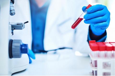 Une hormone, l’adrénomédulline, qui contrôle la pression artérielle et d'autres processus vitaux du corps, stimule également la croissance du cancer (Visuel Fotolia) Une hormone, l’adrénomédulline, qui contrôle la pression artérielle et d'autres processus vitaux du corps, stimule également la croissance du cancer (Visuel Fotolia)