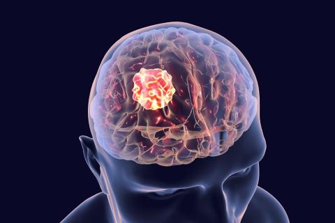 Traiter la douleur arthritique de manière efficace pose toujours problème chez un grand nombre de patients Traiter la douleur arthritique de manière efficace pose toujours problème chez un grand nombre de patients