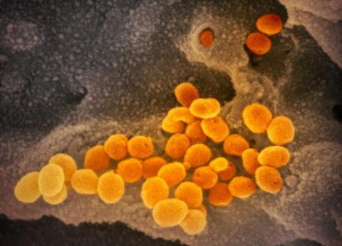 Les animaux traités par le nouvel antiviral ont 100 fois moins de virus infectieux dans leurs poumons que le groupe témoin (Visuel NIAID) Les animaux traités par le nouvel antiviral ont 100 fois moins de virus infectieux dans leurs poumons que le groupe témoin (Visuel NIAID)