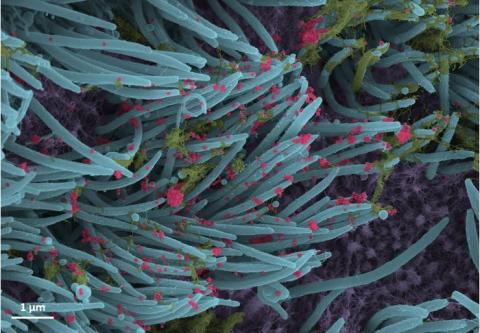 Des images microscopiques et saisissantes de l’infection des cellules épithéliales humaines par le coronavirus SARS-CoV-2 (Visuel Ehre Lab, École de médecine UNC). Des images microscopiques et saisissantes de l’infection des cellules épithéliales humaines par le coronavirus SARS-CoV-2 (Visuel Ehre Lab, École de médecine UNC).
