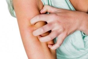 La sensation de démangeaison peut être aussi handicapante que la douleur chronique (Visuel Fotolia) La sensation de démangeaison peut être aussi handicapante que la douleur chronique (Visuel Fotolia)