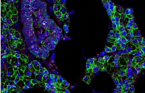 L’ARN du SRAS-CoV-2 (en rose) et du récepteur ACE2 (en blanc) est identifié dans les cellules des glandes salivaires humaines (en vert) (Visuel Paola Perez, PhD, Warner Lab, NIDCR) L’ARN du SRAS-CoV-2 (en rose) et du récepteur ACE2 (en blanc) est identifié dans les cellules des glandes salivaires humaines (en vert) (Visuel Paola Perez, PhD, Warner Lab, NIDCR)