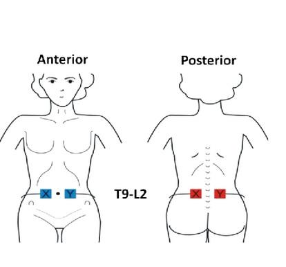 La thérapie consiste en une stimulation électrique sur l'estomac et le dos pendant 1 heure chaque jour La thérapie consiste en une stimulation électrique sur l'estomac et le dos pendant 1 heure chaque jour