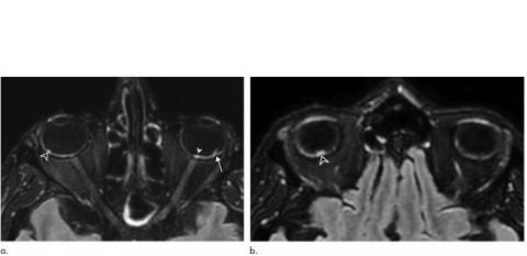 Visuel Radiological Society of North America