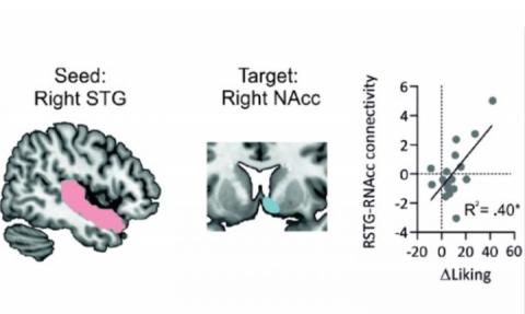 La connexion entre circuits cérébraux auditifs et de la récompense sous-tend le plaisir musical (Visuel Mas-Herrero et al., JNeurosci 2021)