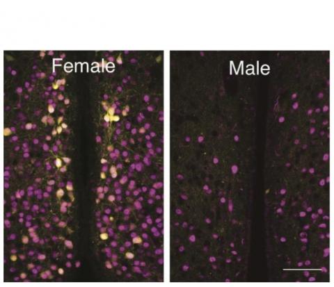 L’expression des récepteurs de l'ocytocine dans ces cellules n'est présente que lorsque des œstrogènes sont également présents.