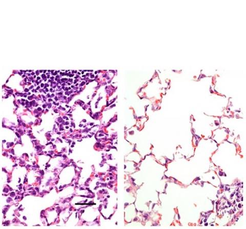 Tissu pulmonaire : vaccination par injection intra-musculaire à gauche et par voie nasale à droite (Visuel Hassan et al.) Tissu pulmonaire : vaccination par injection intra-musculaire à gauche et par voie nasale à droite (Visuel Hassan et al.)