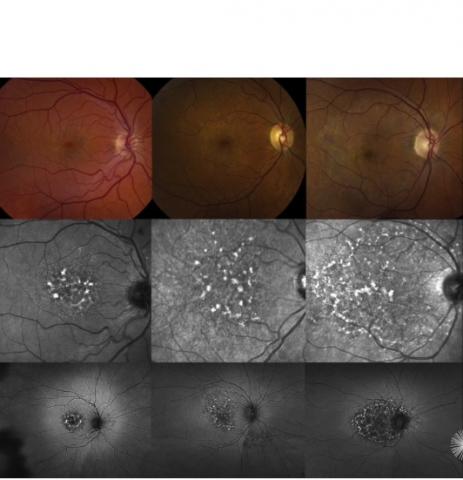 Visuel American Academy of Ophthalmology