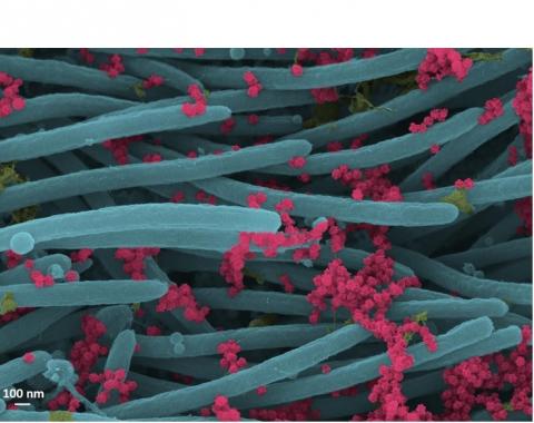 Un nombre incroyablement élevé de virions produits et libérés par chaque cellule du système respiratoire humain (Visuel Ehre Lab, UNC School of Medicine) Un nombre incroyablement élevé de virions produits et libérés par chaque cellule du système respiratoire humain (Visuel Ehre Lab, UNC School of Medicine)