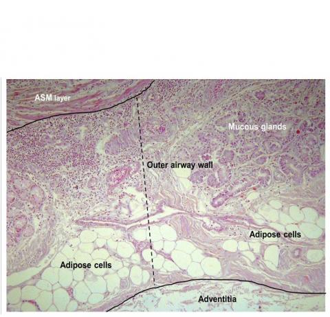 L’accumulation de l'excès de graisse dans les parois des voies respiratoires. « Nous pensons que cela provoque un épaississement des voies respiratoires qui limite le flux d'air entrant et sortant