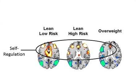 L'étude montre une réduction de l’activité dans les circuits qui supportent l'autorégulation et l'attention chez les adolescents en surpoids et à risque familial d'obésité.