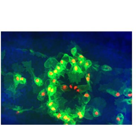 Nos macrophages (en vert) sont nécessaires sur le site de la plaie pour prévenir l’infection et faciliter le processus de cicatrisation