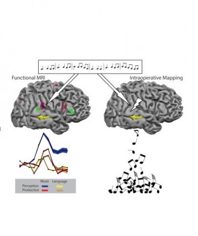 Avec la collaboration d’experts musiciens, l’équipe a donc développé une série de tests cognitifs et musicaux à effectuer par le patient