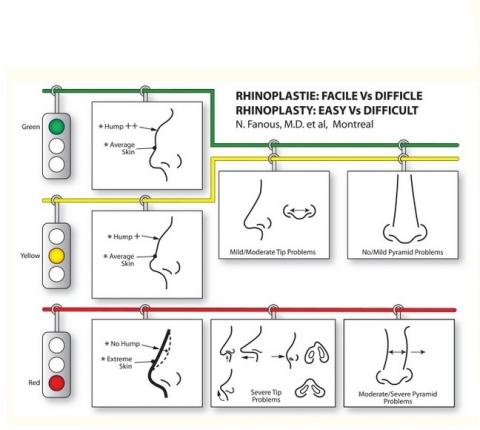 Des approches simples et systématiques ont été documentées dans la littérature (Canadian Journal of Plastic Surgery 2008 Predicting the results of rhinoplasty before surgery: Easy noses versus difficult noses)