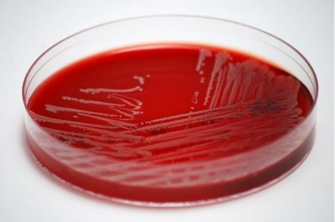 Culture de Staphylococcus aureus